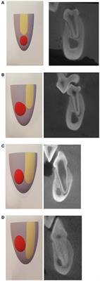 Analysis of the Anatomic Relationship Between the Mandibular First Molar Roots and Mandibular Canal Using Cone-Beam Computed-Tomography in 101 Dogs